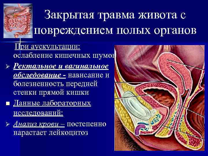 Закрытая травма живота с повреждением полых органов Ø n Ø При аускультации: ослабление кишечных