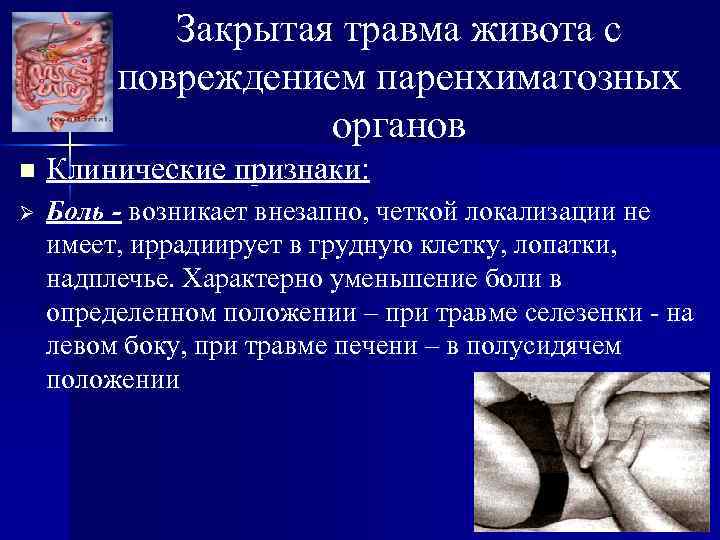 Закрытая травма живота с повреждением паренхиматозных органов n Клинические признаки: Ø Боль - возникает