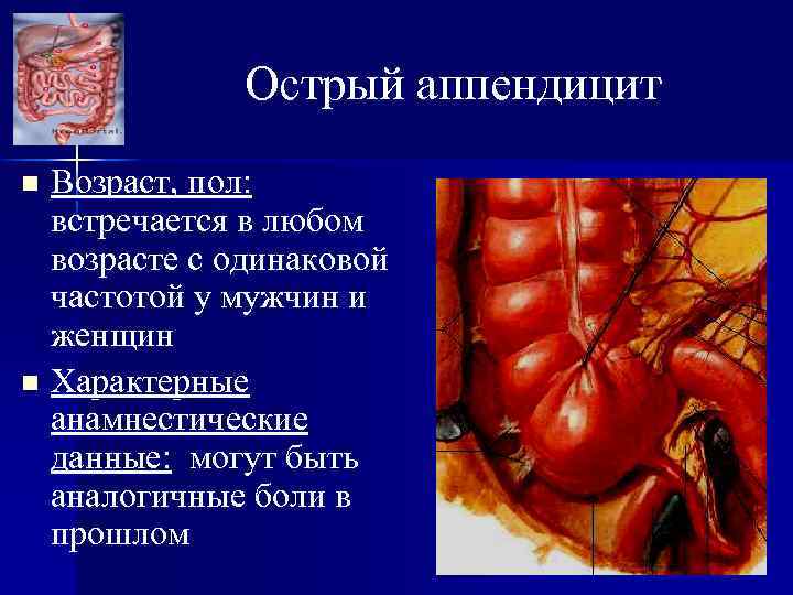 Острый аппендицит Возраст, пол: встречается в любом возрасте с одинаковой частотой у мужчин и