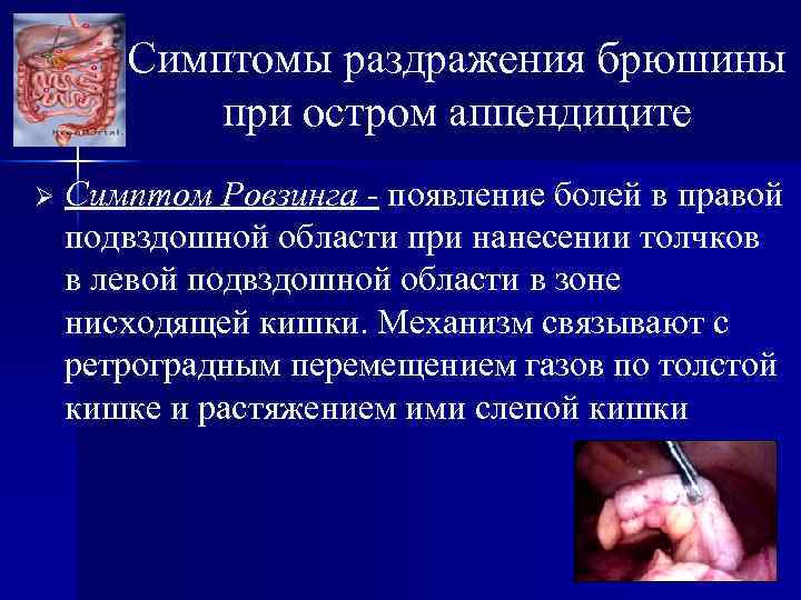 Симптомы раздражения брюшины при остром аппендиците Ø Симптом Ровзинга - появление болей в правой