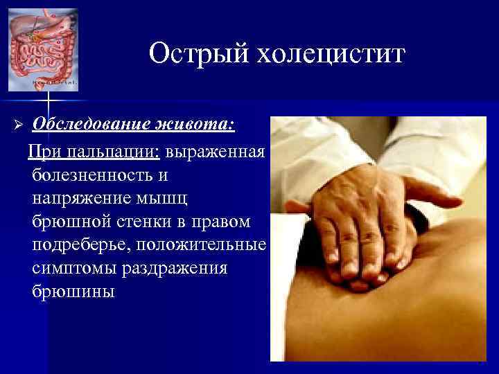 Острый холецистит Ø Обследование живота: При пальпации: выраженная болезненность и напряжение мышц брюшной стенки
