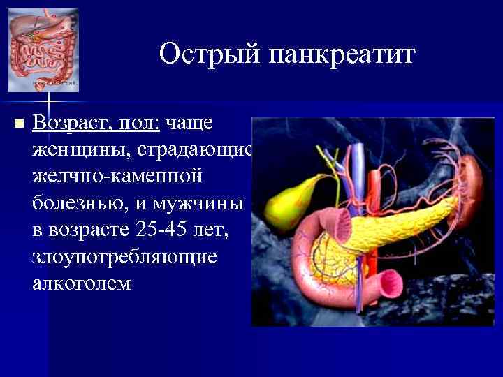 Острый панкреатит n Возраст, пол: чаще женщины, страдающие желчно-каменной болезнью, и мужчины в возрасте