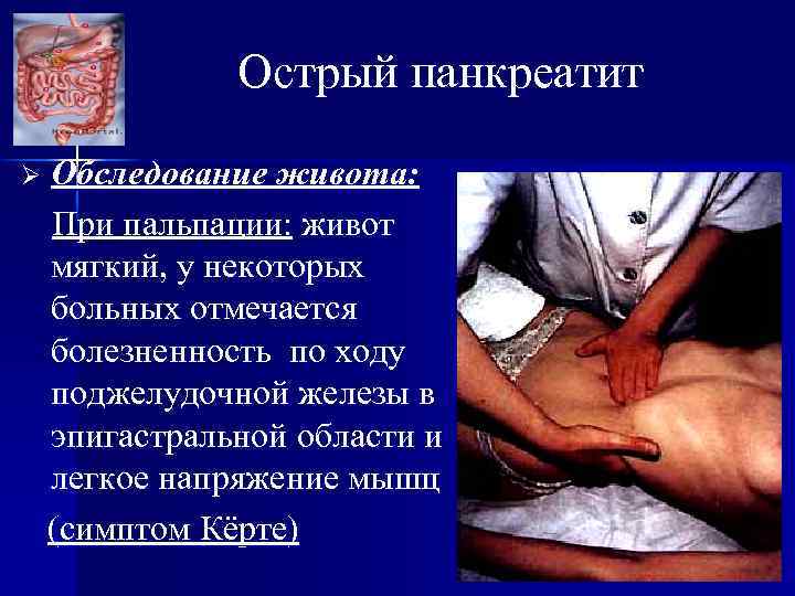 Острый панкреатит Ø Обследование живота: При пальпации: живот мягкий, у некоторых больных отмечается болезненность