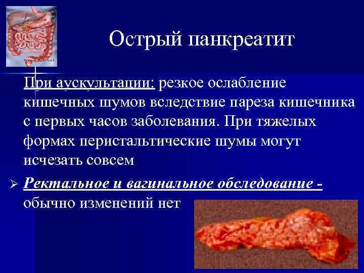 Острый панкреатит При аускультации: резкое ослабление кишечных шумов вследствие пареза кишечника с первых часов