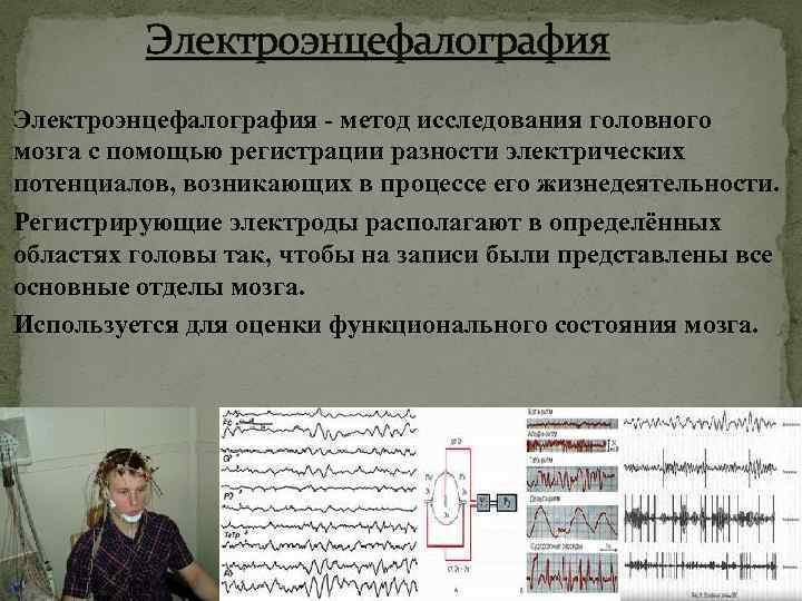 Электроэнцефалография - метод исследования головного мозга с помощью регистрации разности электрических потенциалов, возникающих в