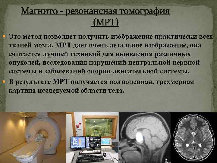 Магнито - резонансная томография (МРТ) Это метод позволяет получить изображение практически всех тканей мозга.