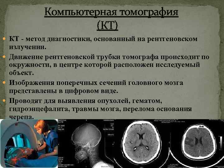 Компьютерная томография (КТ) КТ - метод диагностики, основанный на рентгеновском излучении. Движение рентгеновской трубки