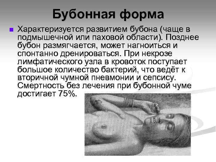 Бубонная форма n Характеризуется развитием бубона (чаще в подмышечной или паховой области). Позднее бубон