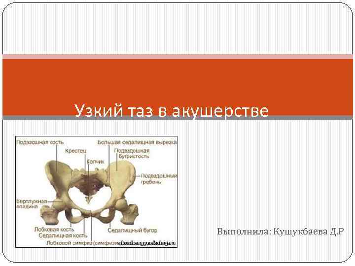 Узкий таз в акушерстве Выполнила: Кушукбаева Д. Р 