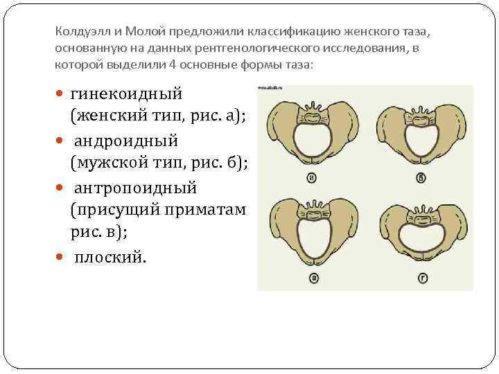 Гинекоидный таз. Сужения таза в акушерстве. Формы сужения таза. Типы таза у женщин. Часто встречающиеся формы узкого таза.