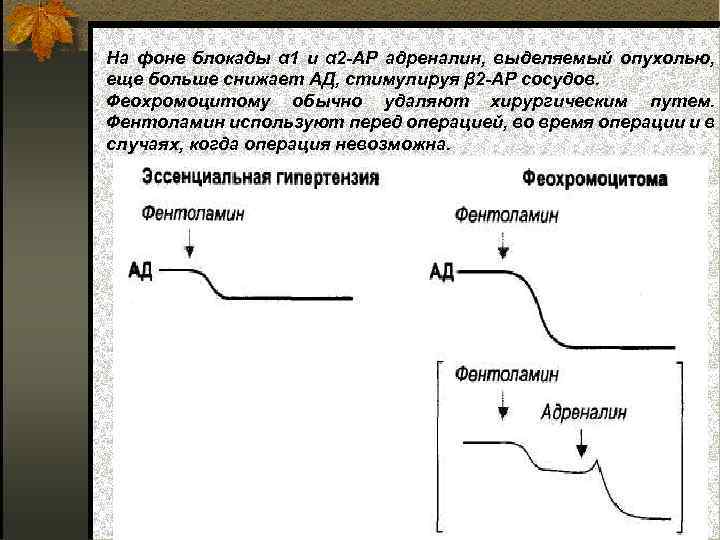 На фоне блокады α 1 и α 2 -АР адреналин, выделяемый опухолью, еще больше