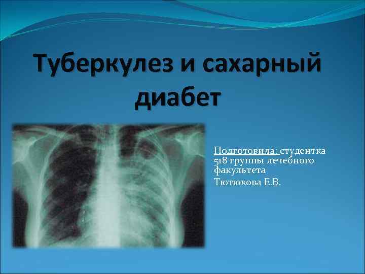 Туберкулез и сахарный диабет Подготовила: студентка 518 группы лечебного факультета Тютюкова Е. В. 