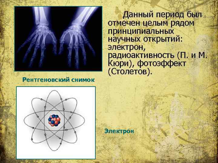 Рентгеновский снимок Данный период был отмечен целым рядом принципиальных научных открытий: электрон, радиоактивность (П.