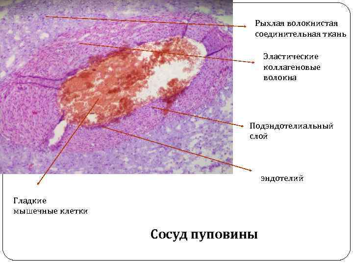 Рыхлая волокнистая соединительная ткань волокна. Подэндотелиальный слой. Рыхлая соединительная ткань коллагеновые и эластичные волокна. Подэндотелиальный слой гистология. Перициты гистология препарат.