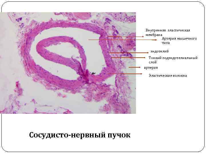 Внутренняя эластическая мембрана Артерия мышечного типа эндотелий Тонкий подэндотелиальный слой артерия Эластические волокна Сосудисто-нервный
