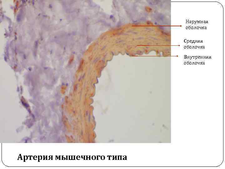 Наружная оболочка Средняя оболочка Внутренняя оболочка Артерия мышечного типа 