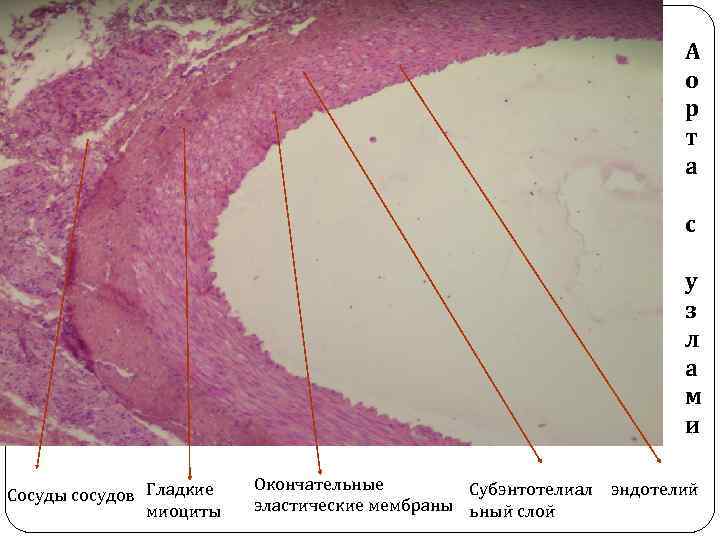 А о р т а с у з л а м и Сосуды сосудов