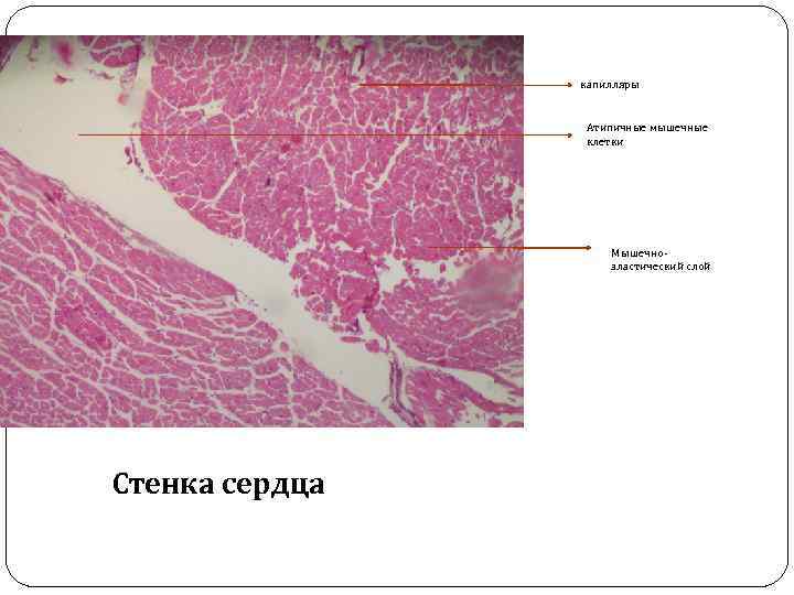капилляры Атипичные мышечные клетки Мышечноэластический слой Стенка сердца 