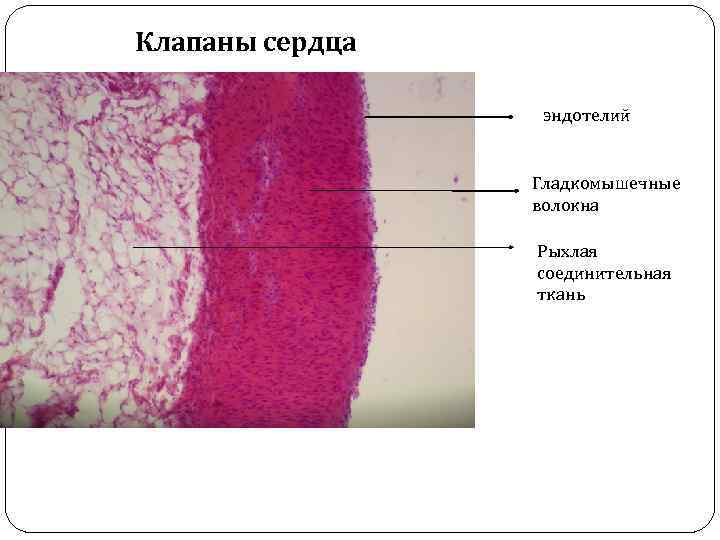 Митральный клапан гистология рисунок