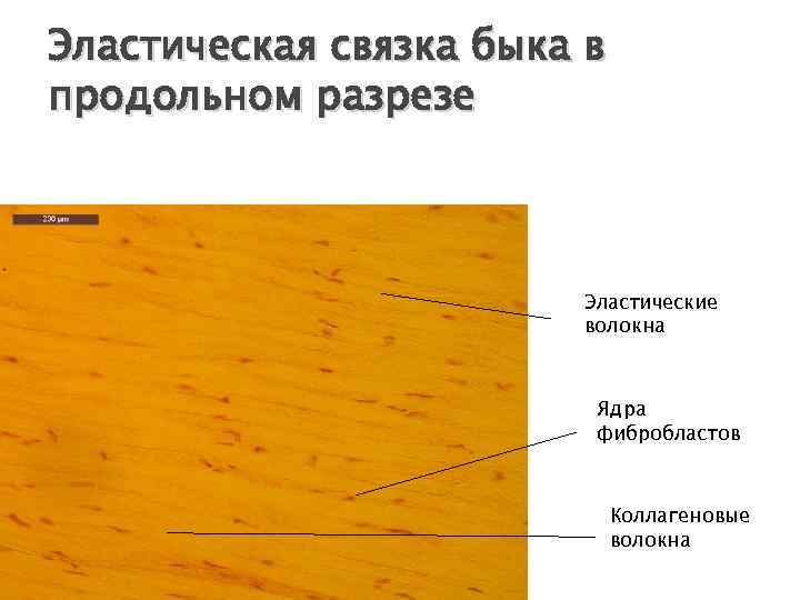 Эластическая связка. Плотная оформленная соединительная ткань выйная связка. Эластическая оформленная волокнистая соединительная ткань. Плотная оформленная соединительная ткань эластического типа. Плотная оформленная соединительная ткань эластическая связка.