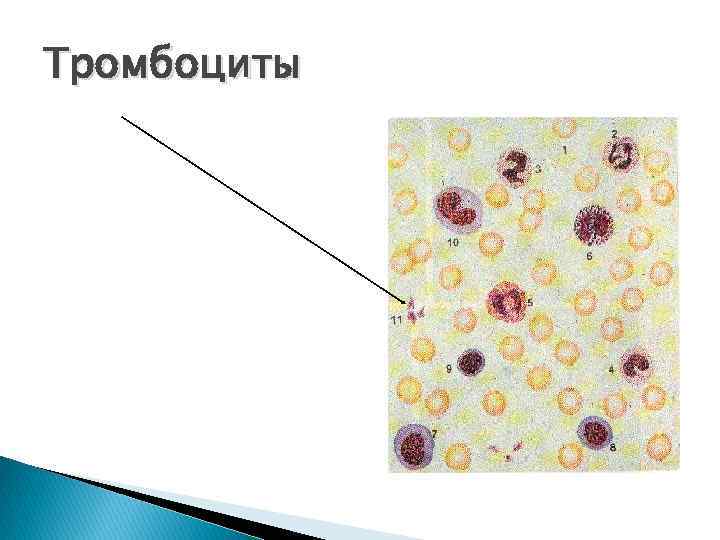 Тромбоциты 