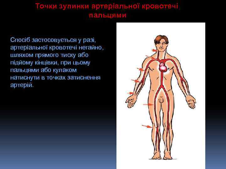 Точки зупинки артеріальної кровотечі пальцями Спосіб застосовується у разі, артеріальної кровотечі негайно, шляхом прямого