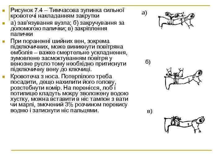 n n Рисунок 7. 4 – Тимчасова зупинка сильної кровотечі накладанням закрутки а) зав’язування