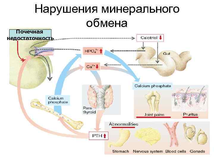 Минеральный обмен. Нарушение минерального обмена таблица. Нарушение минерального обмена патология. Патофизиология минерального обмена. Причины нарушения обмена Минеральных веществ.