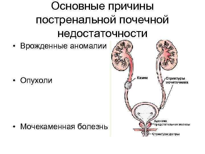 Аномалии мочеточников презентация