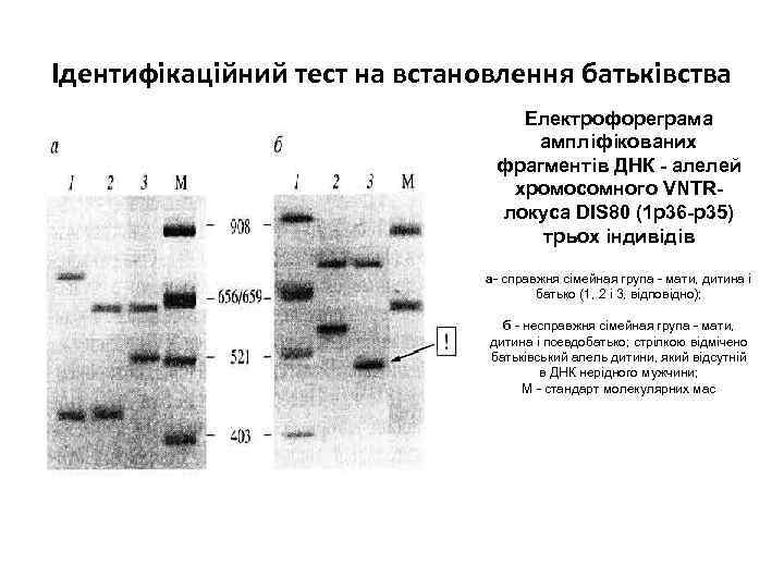 Ідентифікаційний тест на встановлення батьківства Електрофореграма ампліфікованих фрагментів ДНК - алелей хромосомного VNTRлокуса DIS