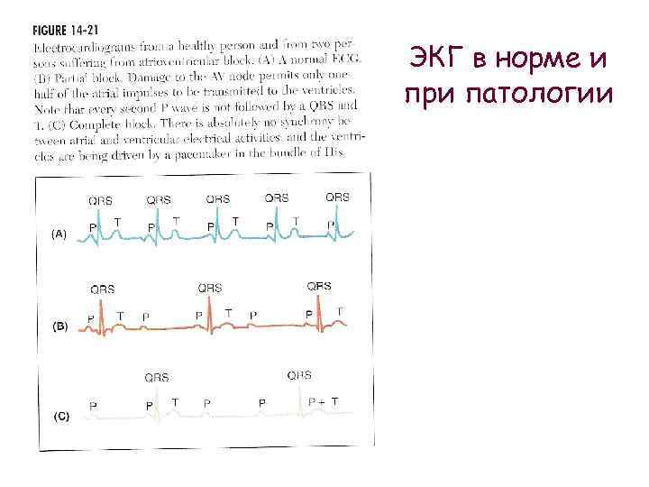 ЭКГ в норме и при патологии 