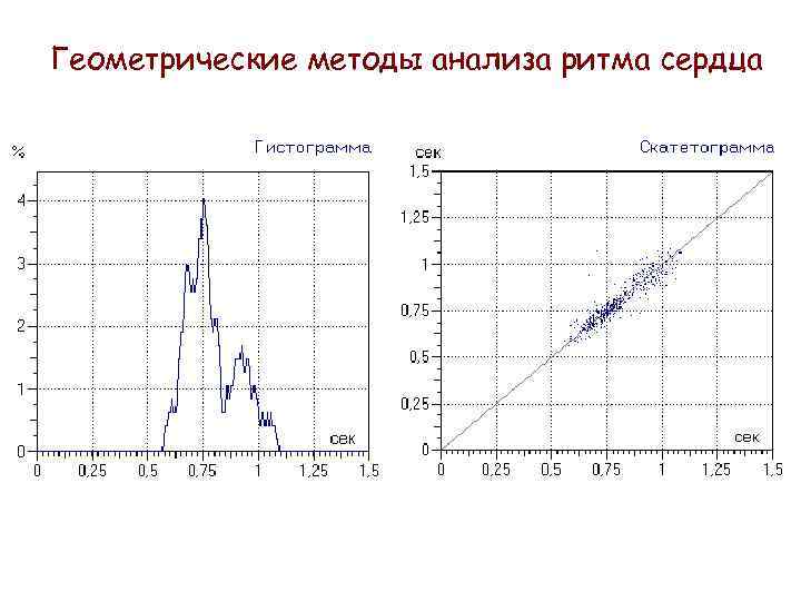 Геометрические методы анализа ритма сердца 