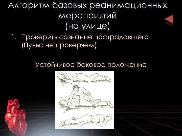Алгоритм базовых реанимационных мероприятий (на улице) 1. Проверить сознание пострадавшего (Пульс не проверяем) Устойчивое