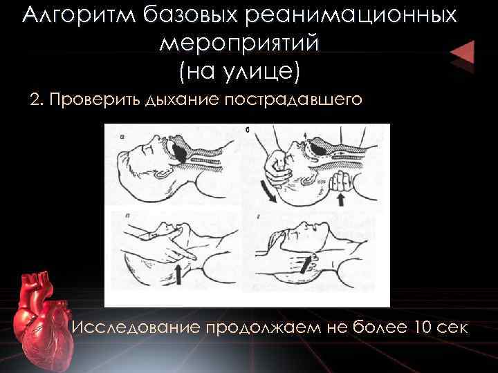 Алгоритм базовых реанимационных мероприятий (на улице) 2. Проверить дыхание пострадавшего Исследование продолжаем не более