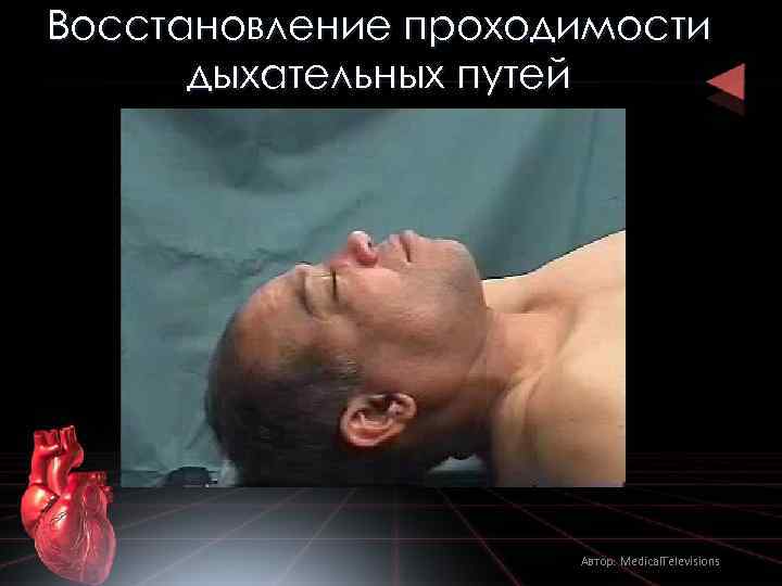 Восстановление проходимости дыхательных путей Автор: Medical. Televisions 