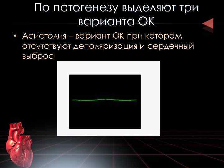 По патогенезу выделяют три варианта ОК • Асистолия – вариант ОК при котором отсутствуют