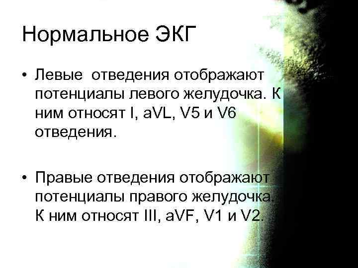 Нормальное ЭКГ • Левые отведения отображают потенциалы левого желудочка. К ним относят I, a.