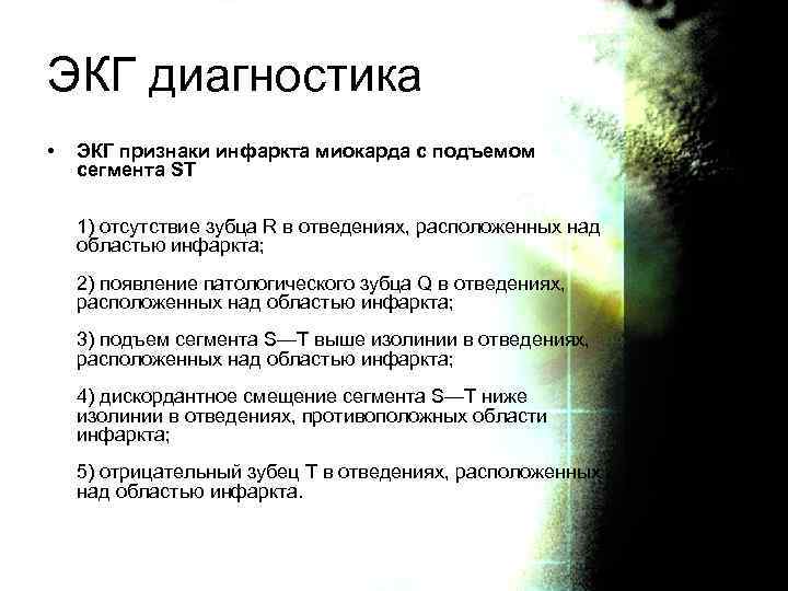 ЭКГ диагностика • ЭКГ признаки инфаркта миокарда с подъемом сегмента ST 1) отсутствие зубца