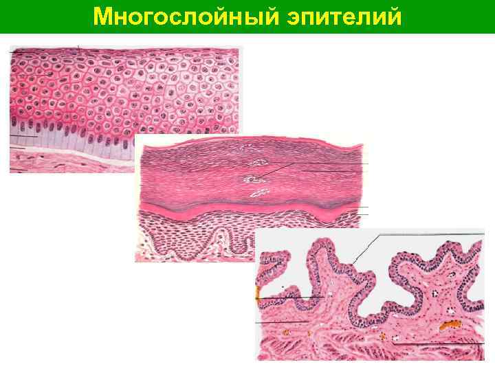 Многослойный эпителий 