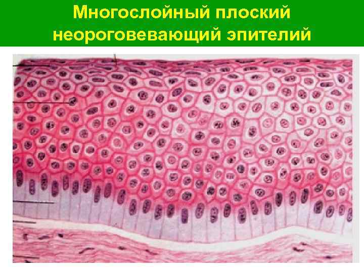 Многослойный плоский неороговевающий эпителий 