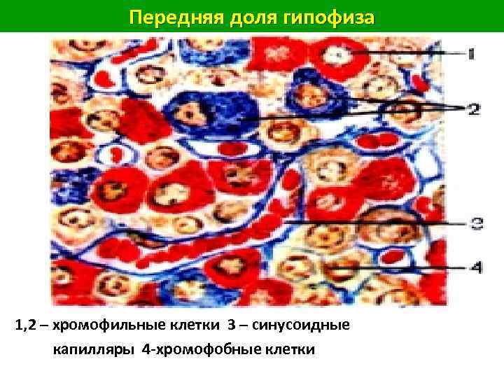 Передняя доля гипофиза 1, 2 – хромофильные клетки 3 – синусоидные капилляры 4 -хромофобные