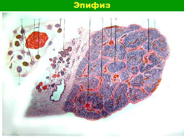 Эпифиз 