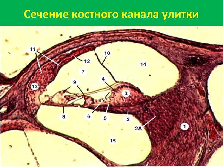 Сечение костного канала улитки 
