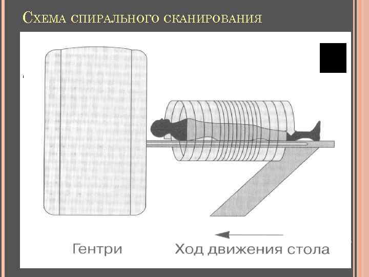 СХЕМА СПИРАЛЬНОГО СКАНИРОВАНИЯ 