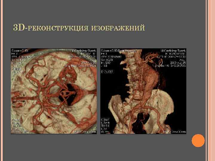 3 D-РЕКОНСТРУКЦИЯ ИЗОБРАЖЕНИЙ 