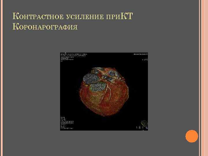 КОНТРАСТНОЕ УСИЛЕНИЕ ПРИКТ КОРОНАРОГРАФИЯ 