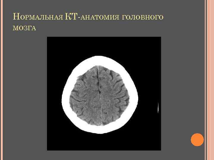 НОРМАЛЬНАЯ КТ-АНАТОМИЯ ГОЛОВНОГО МОЗГА 