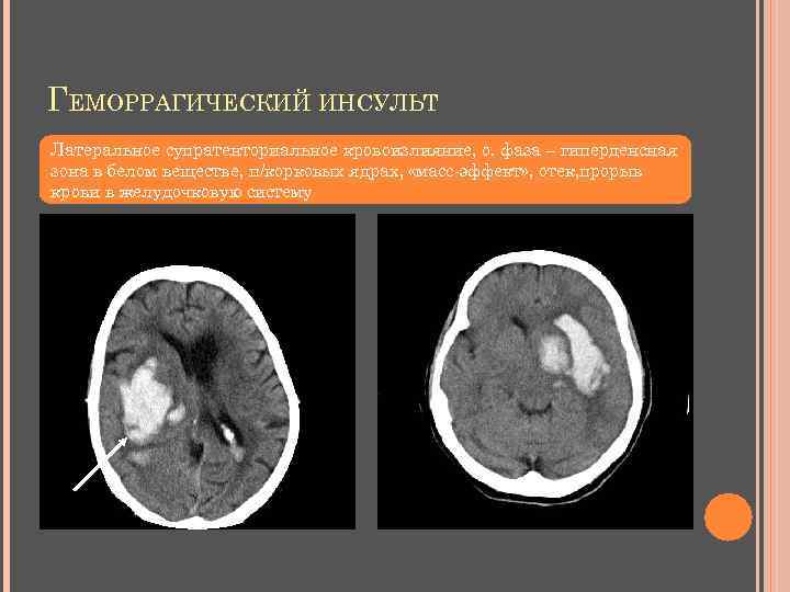 В каких случаях показана компьютерная рентгеновская томография пораженного сустава тест