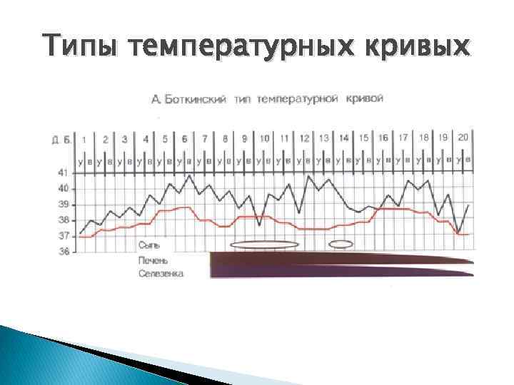 Ковид нет температуры. Температурная кривая Боткина. Типы температурных кривых. Боткинский Тип температурной Кривой. Боткинская температурная кривая.