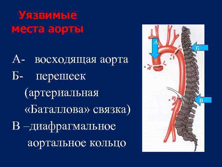 Нисходящая аорта норма